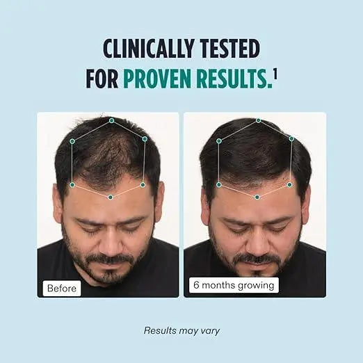Nutrafol Men's Hair Growth Supplements Pack of 2, Clinically Tested for Visibly Thicker Hair and Scalp Coverage, Dermatologist Recommended - 1 Month - Jia Sales