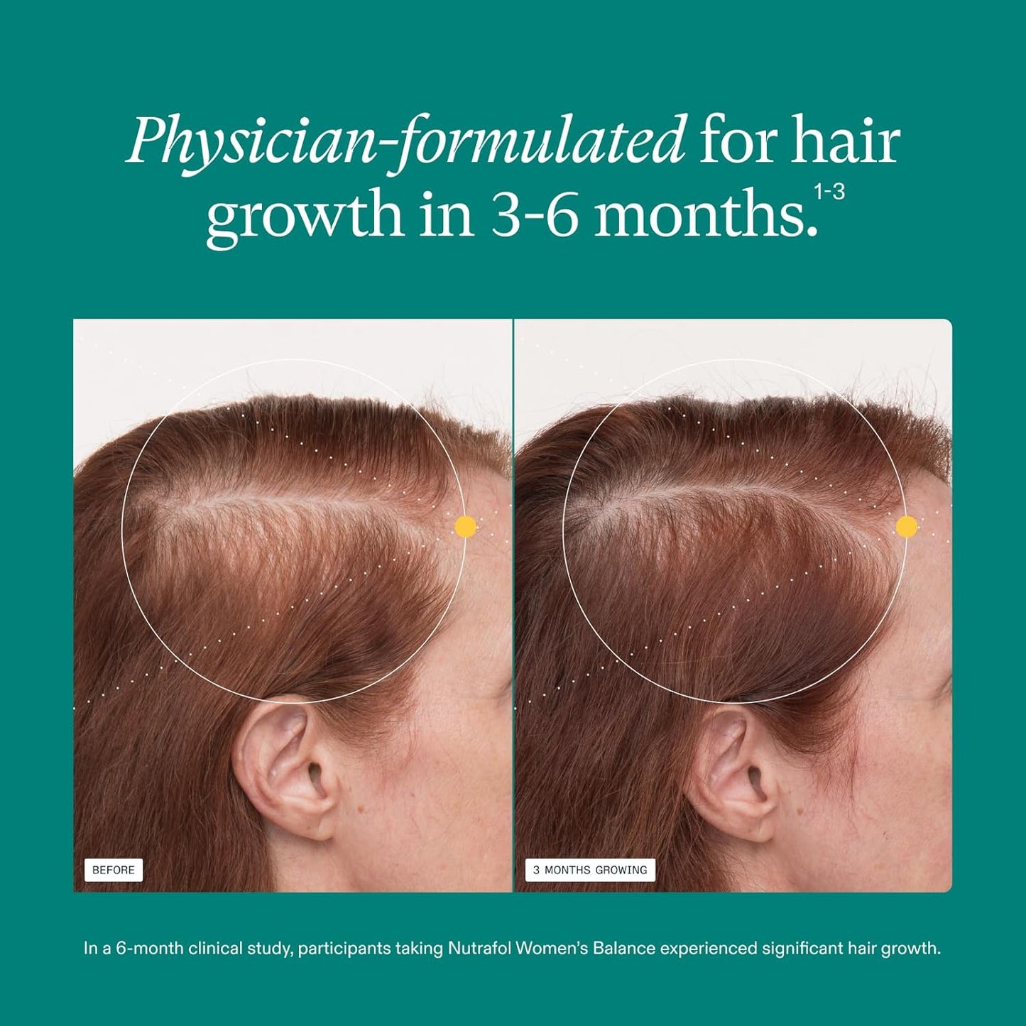 Women's Balance Hair Growth Supplements, Ages 45 and Up