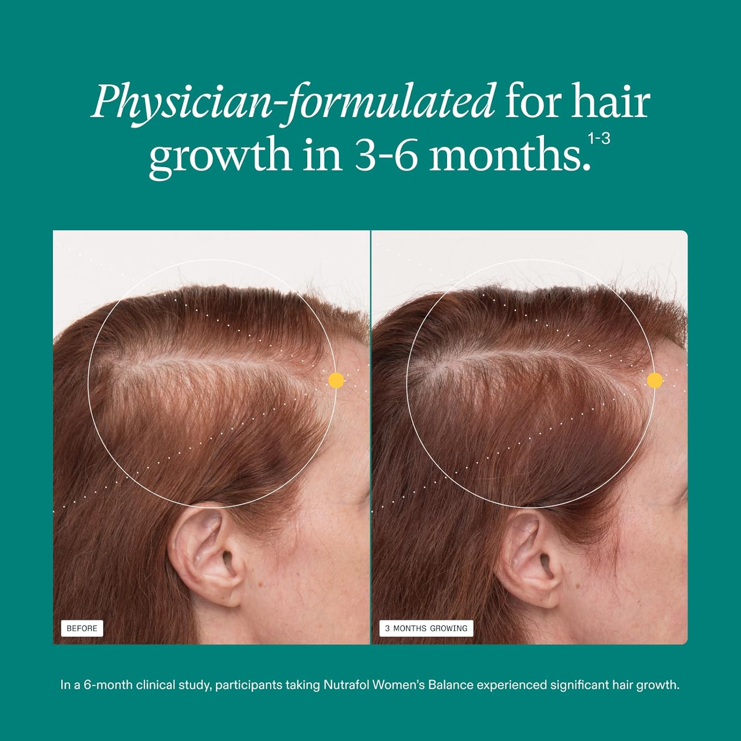 Nutrafol Women's Hair Growth Nutraceutical Ages 45 and Up,