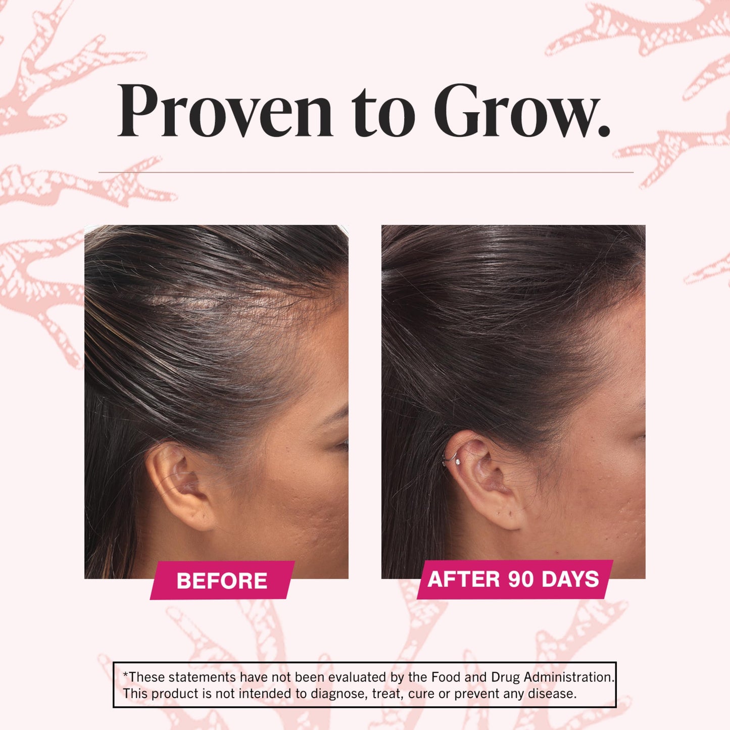 Viviscal Hair Growth Dietary Supplement